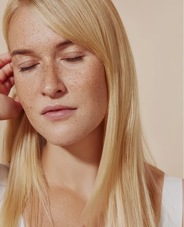 Botox for migraines