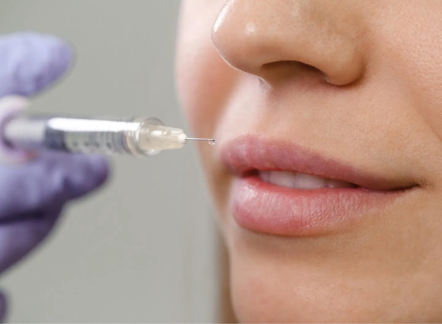 Fillers For Lips