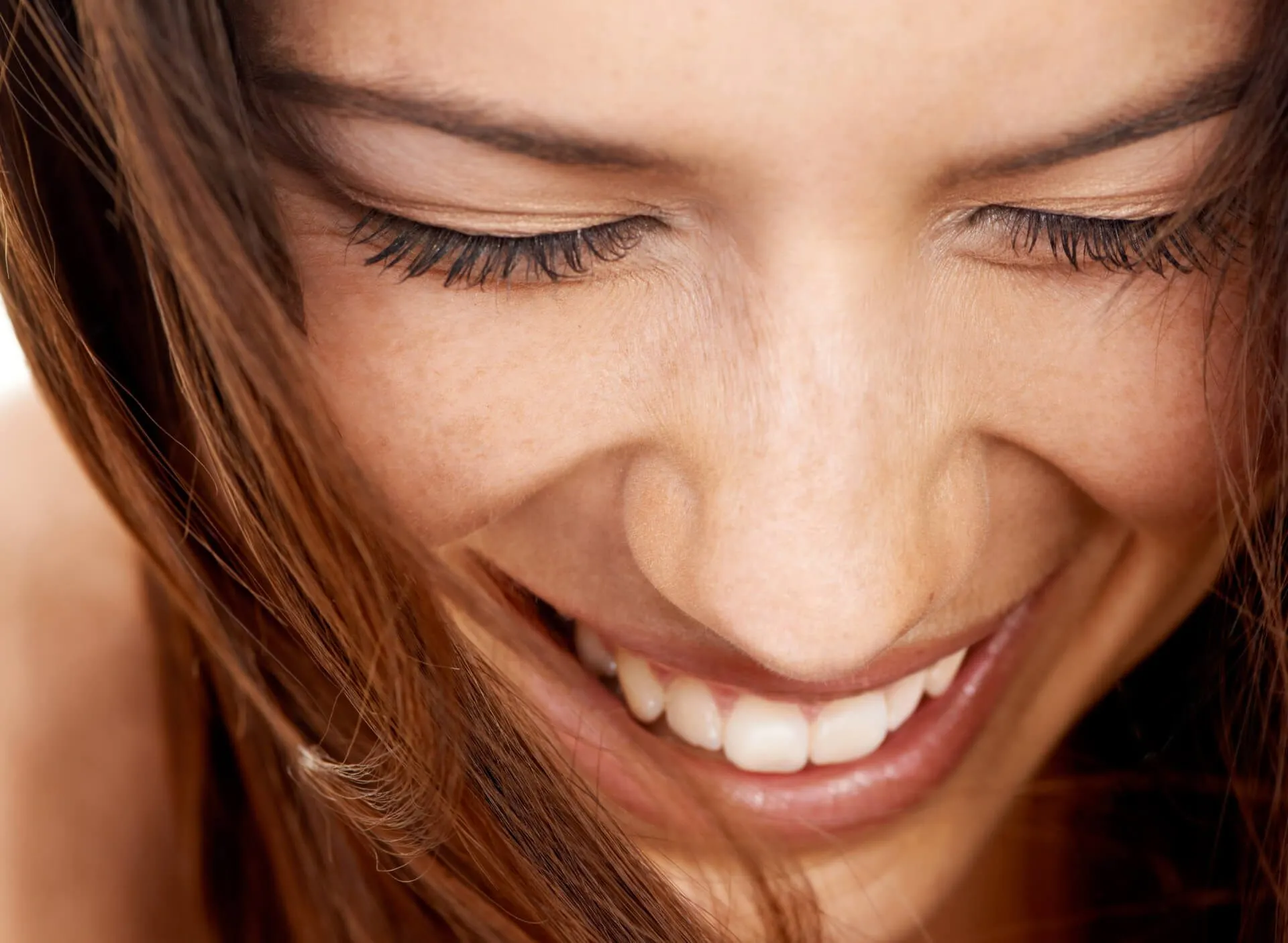 Botox Crows Feet - rtwskin clinic