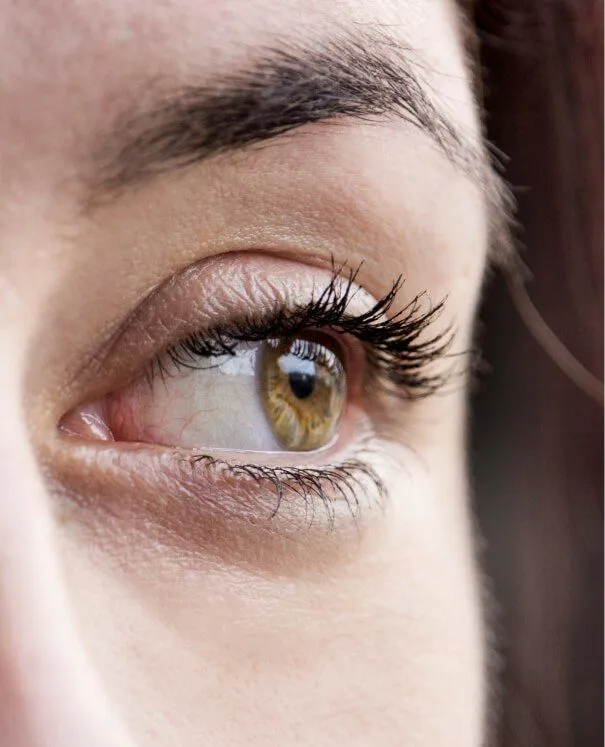 Fillers for Tear Trough m