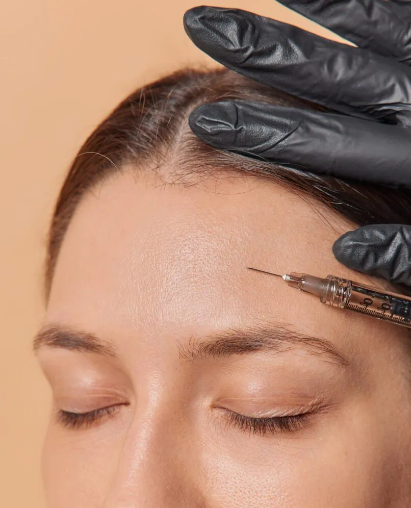 Frown Lines Botox m