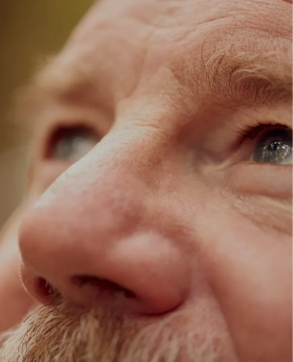 Rhinophyma small