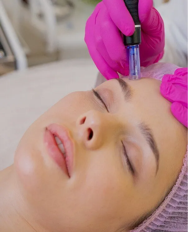 Dermapen small