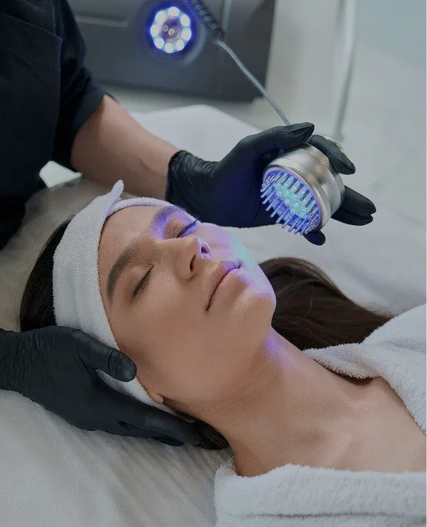 IPL Photo Rejuvenation м
