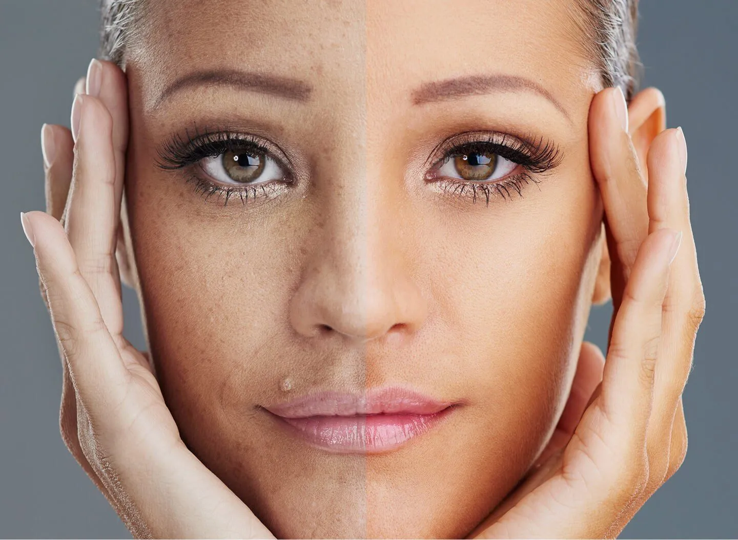 Pigmentation