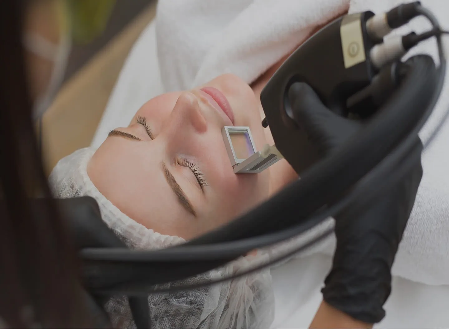 Skin Rejuvenation