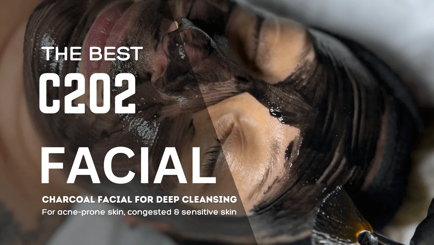 What Makes the Charcoal C2O2 Facial So Amazing?