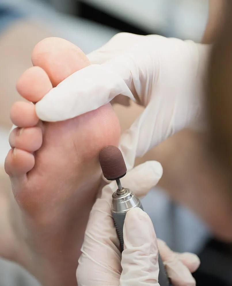 Medical Pedicure