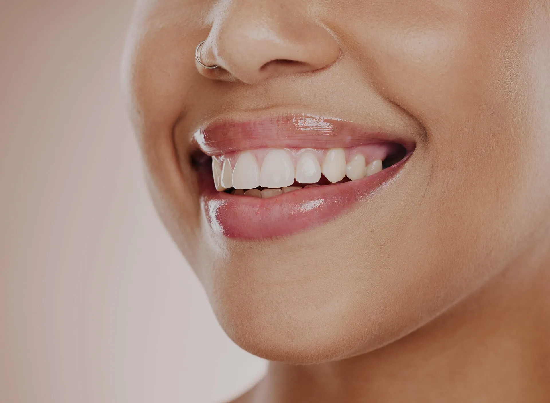 Teeth Whitening